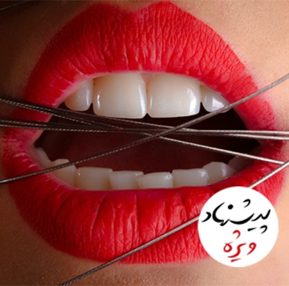 فروش ویژه محصولات آرایشی بهداشتی کامنت Comment در تبریز